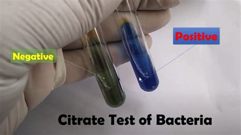 citrate test positive result